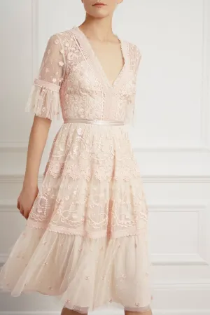 Midsummer Lace Dress Relax Style Urban Aesthetic